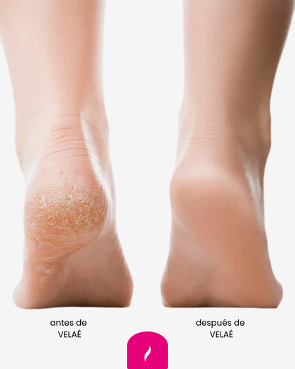 VELAÉ SoftPro: Resultados visibles al instante: pies renovados, suaves, sin callos y grietas.